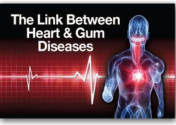 Periodontal Disease and Heart Disease