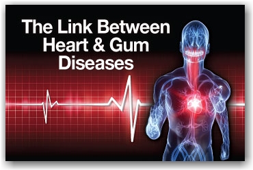 Periodontal Disease and Heart Disease