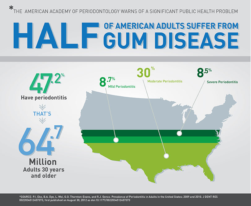 Half of American adults suffer from gum disease