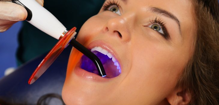 Kor kæmpe stor afbrudt What is an LED curing light when it comes to dental work?