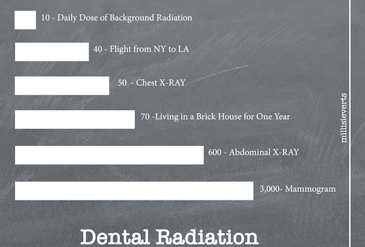 digital x-rays