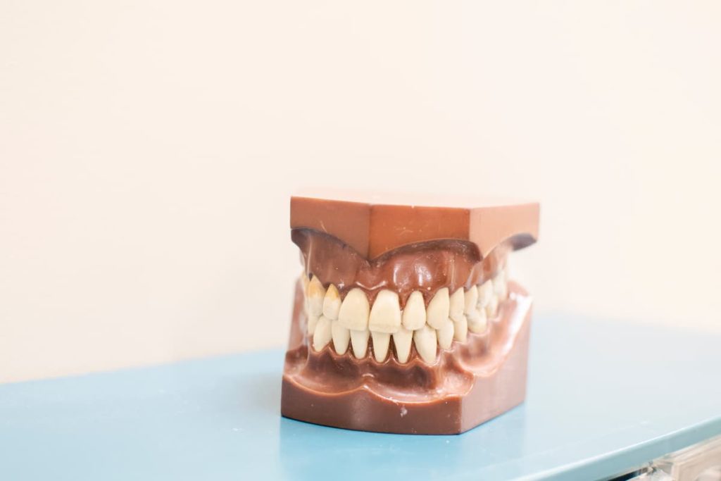 Cast of teeth A cast of teeth being restored at the dentist