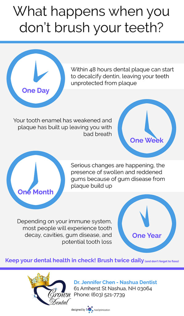 Infographic showing a timeline of what happens when you don't brush your teeth.