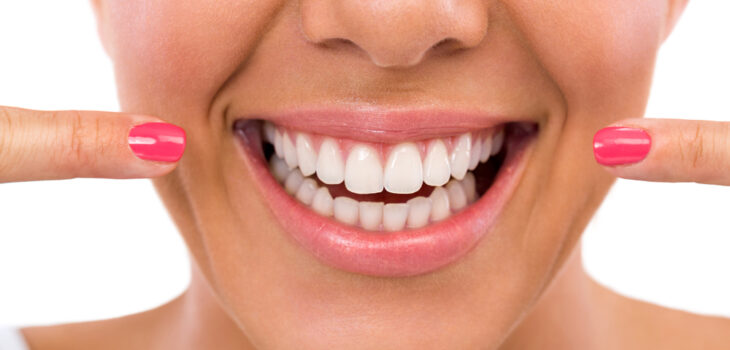 Woman showing her perfect teeth